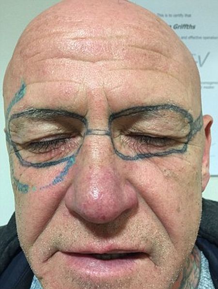 После веселой вечеринки британец обнаружил странное тату на своем лице 