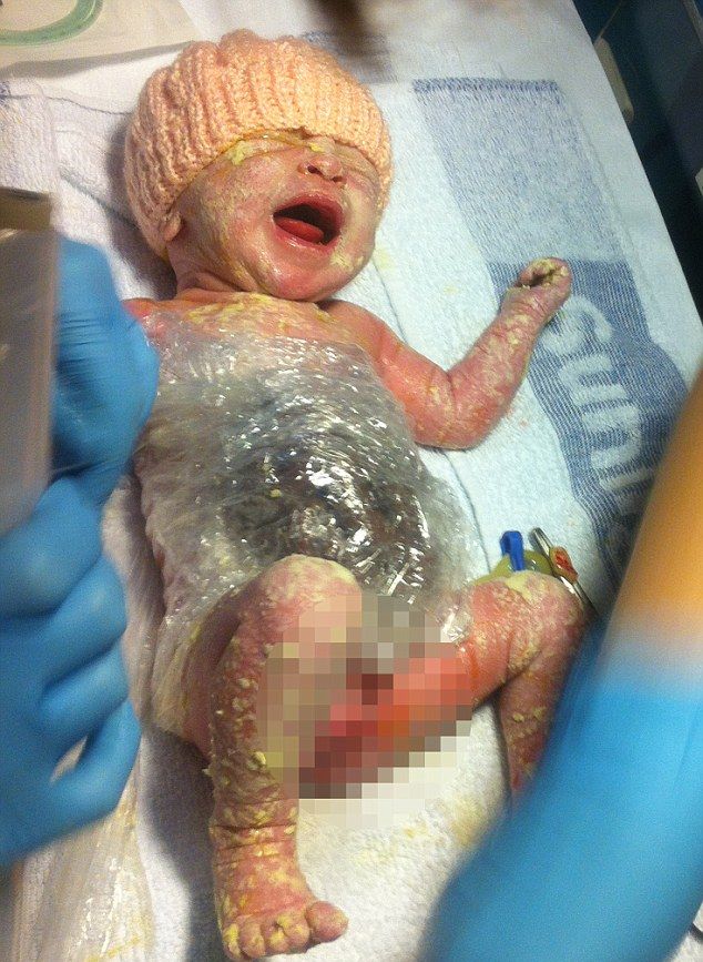 Новорожденную пришлось обмотать упаковочной пленкой, чтобы не повредить выпавшие внутренние органы 