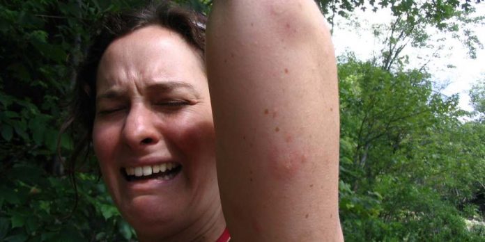 7 причин того, что комары кусают вас больше, чем других