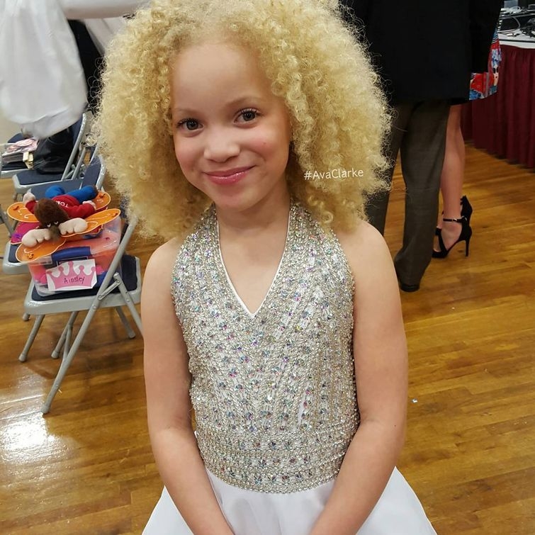 Ава Кларк – 8-летняя девочка-альбинос, ставшая юной афроамериканской моделью 