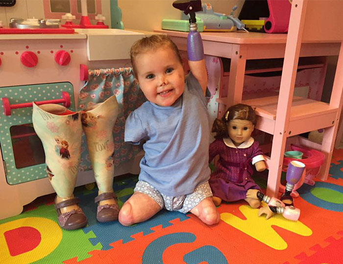 Двухлетняя девочка получила куклу-ампутанта, выглядящую так, как и она сама 