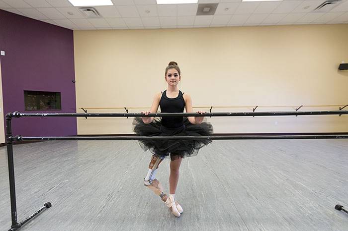 Эта балерина, потерявшая ногу из-за рака, снова может танцевать 