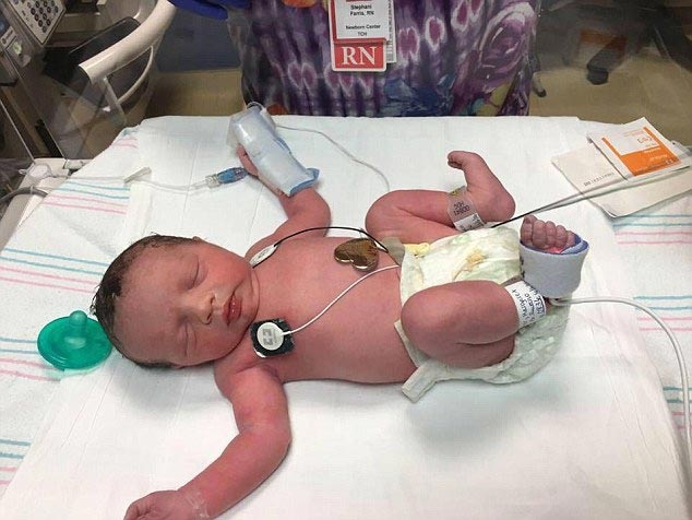 Эта девочка родилась дважды, так как её эмбрион необходимо было извлечь для операции 