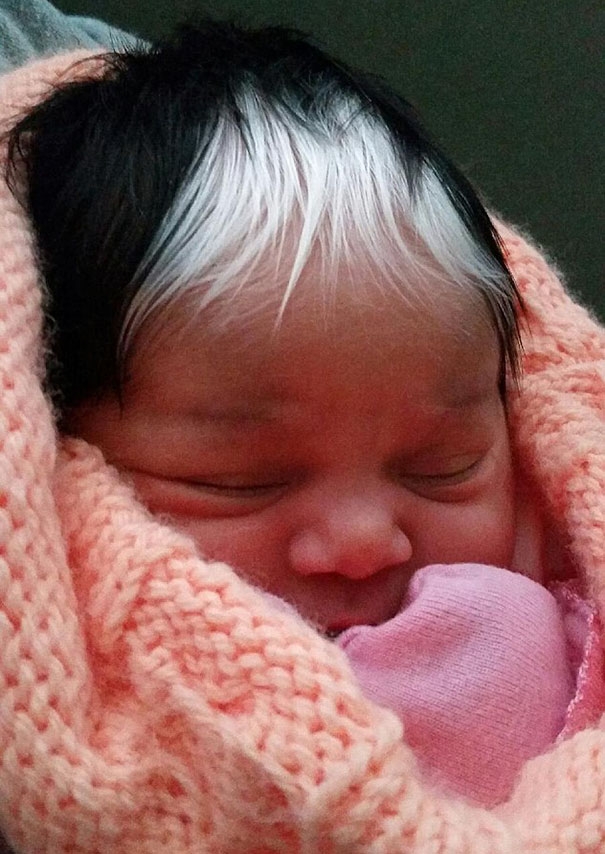 Маленькая девочка родилась с такой же уникальной белой прядкой волос, как и её мама 