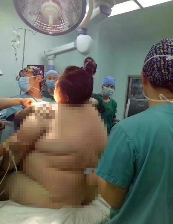 Чтобы принять роды у тучной женщины понадобилось 16 медицинских работников 