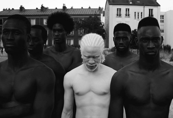 Этот нежный фотопроект об удивительных альбиносах заставит тебя по-другому взглянуть на «особенных» 
