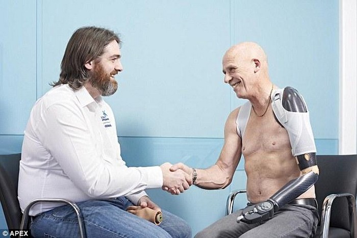 Бионическая рука - спустя 40 лет после аварии