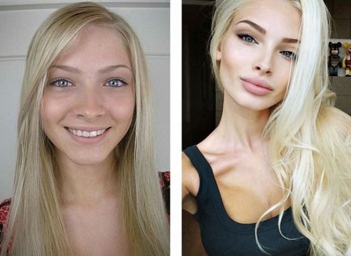 Известные россиянки до и после пластики 