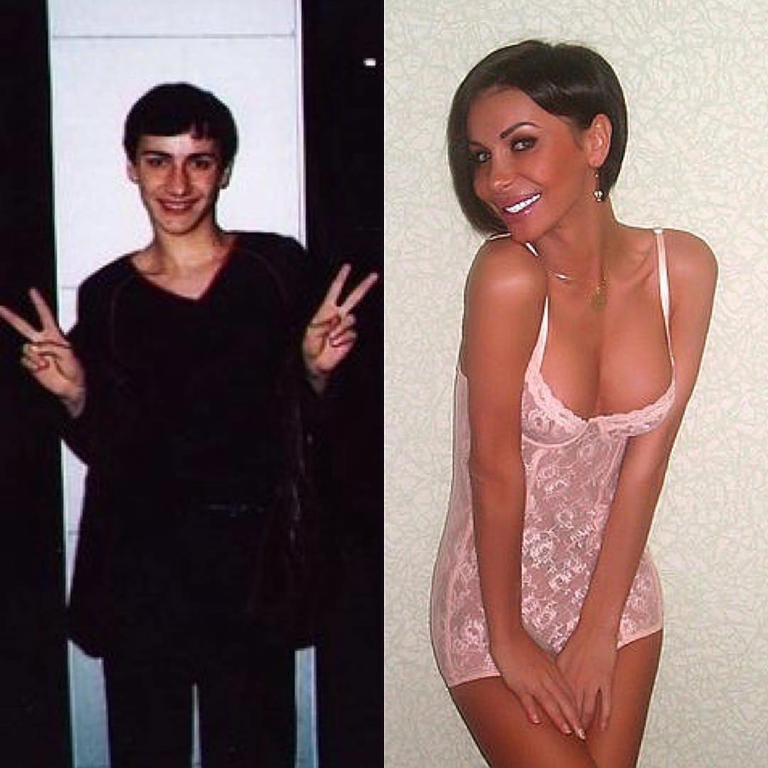 Трансгендеры россии фото органов до и после